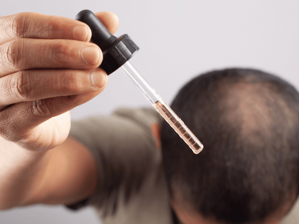 a man using topical for hair loss