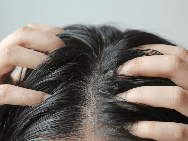 an image of a woman holding her scalp with two hands
