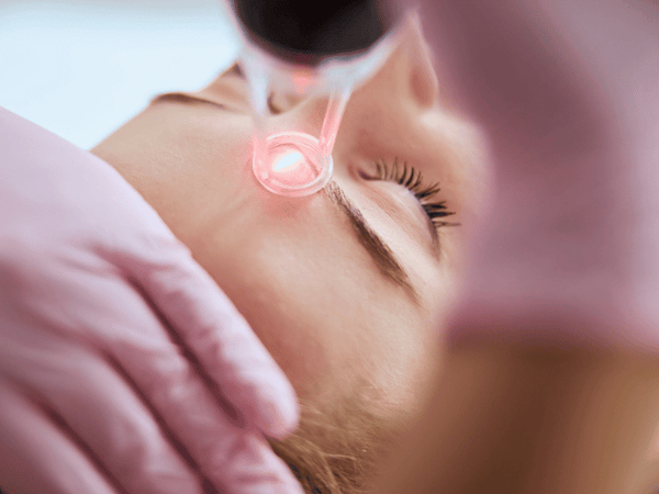 an image of a woman undergoing laser treatment on her face.