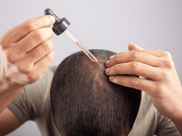 a man using topical solution on his scalp.