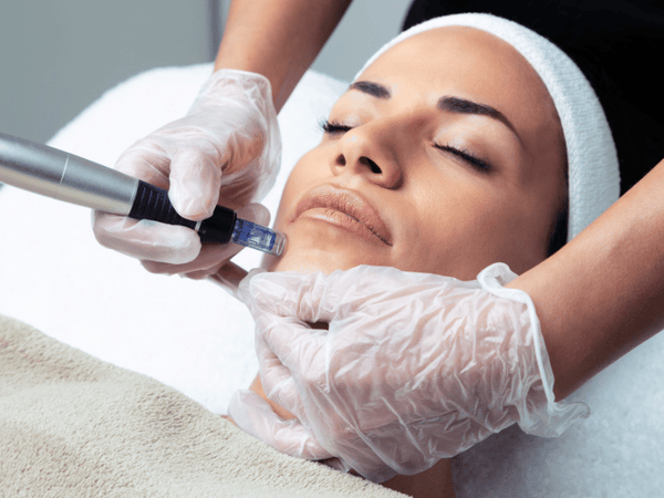 What is Microneedling