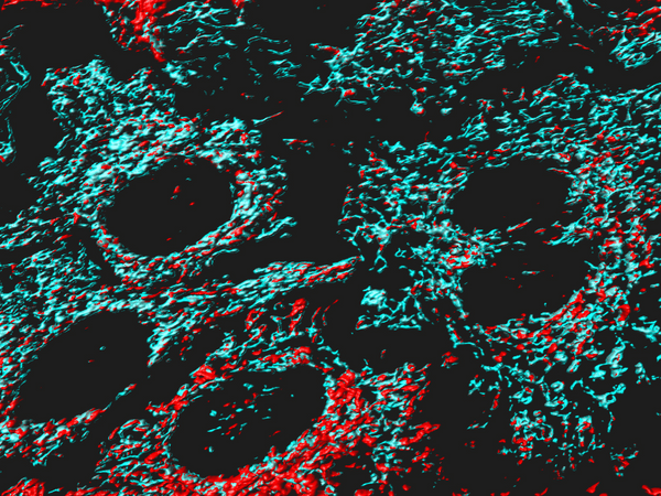 a microscopic image of mitochondria.