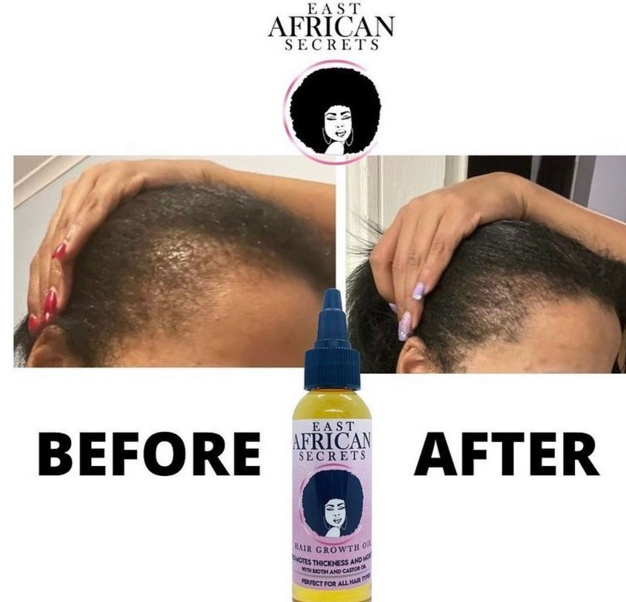 Rapid Hair Growth Oil - East African Secrets