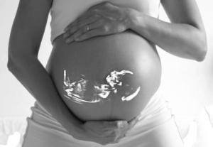 Snugglebundl - Ultrasound Decisions Blog - Ultrasound of a baby projected onto a mothers stomach