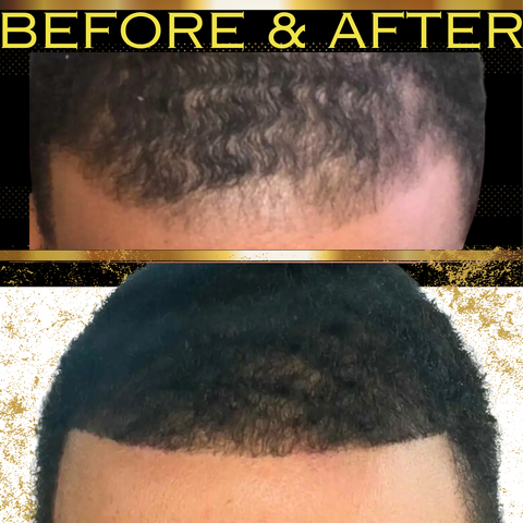 A man’s hair growth transformation from Bask and Lather’s products