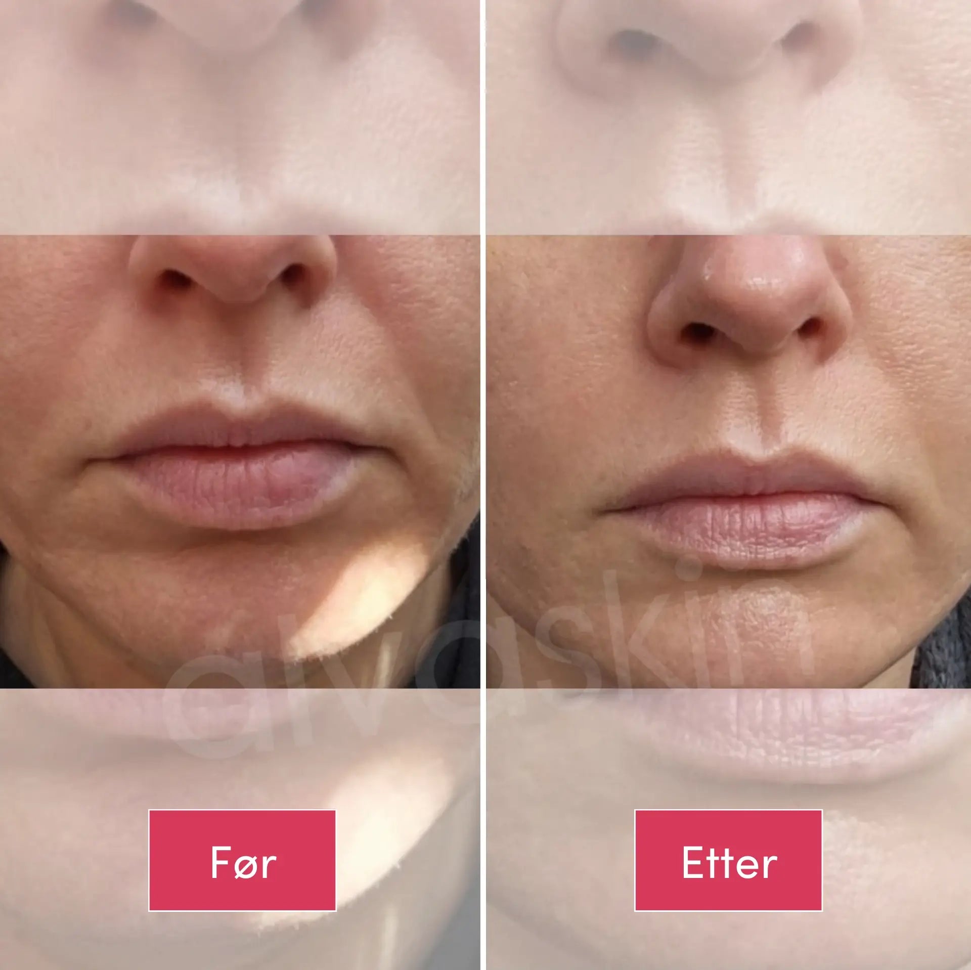 Before & after Electra 3.webp__PID:4d359981-1369-452c-ab5f-0e04d2e78586