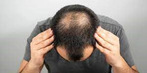 Uses and Dosage of Saw Palmetto hair loss