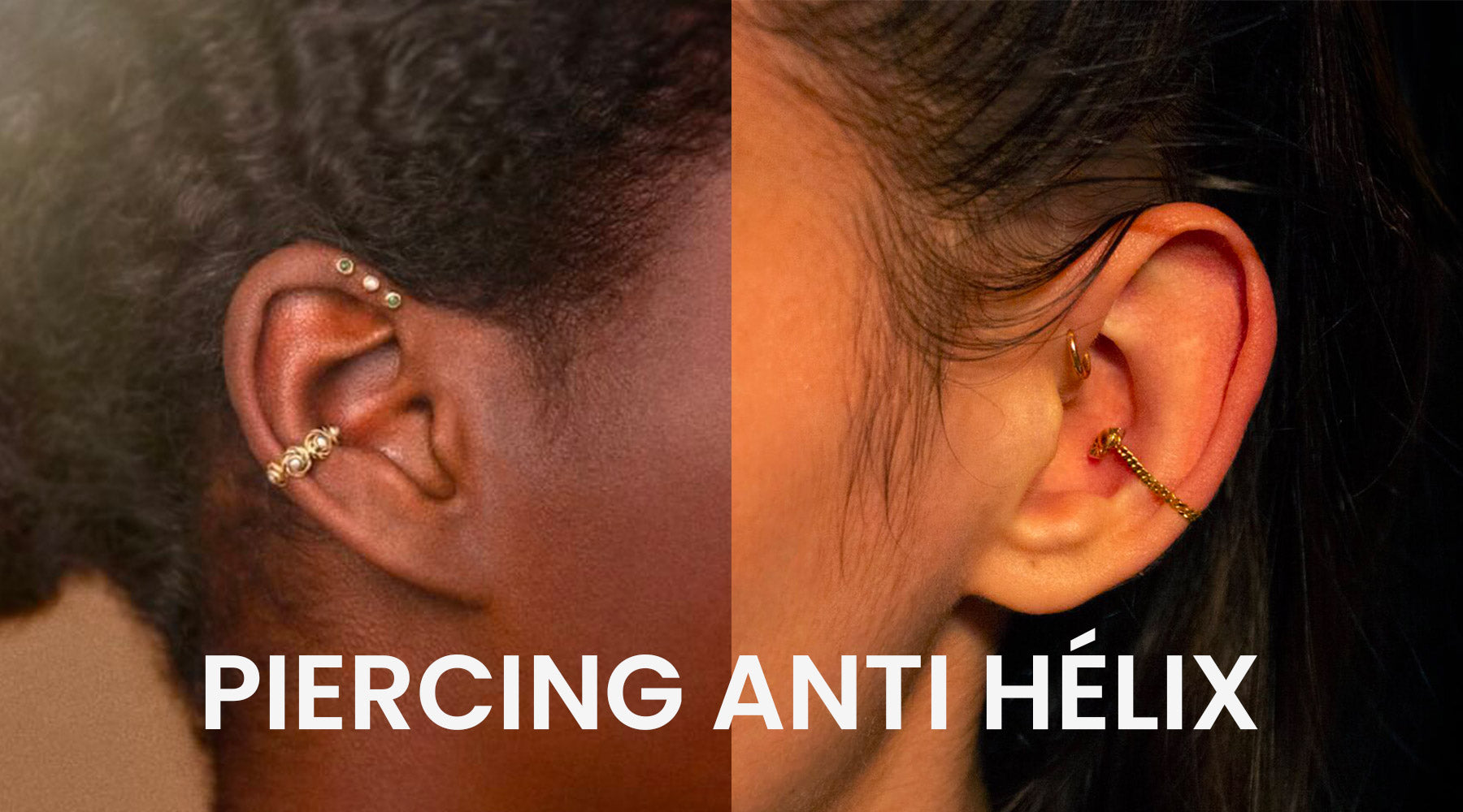 What Is A Keloid? Piercing Hypertrophic Scars Explained | atelier-yuwa ...