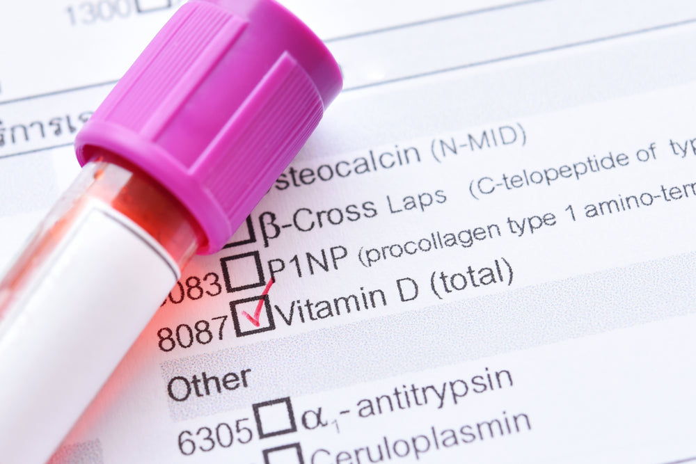 At-Home Vitamin D Tests