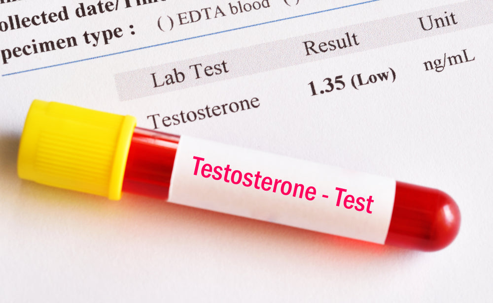 When to Take a Testosterone Blood Test