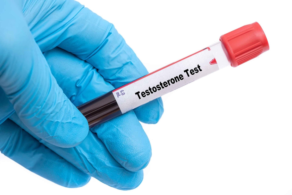 Why Take an At-Home Testosterone Test?