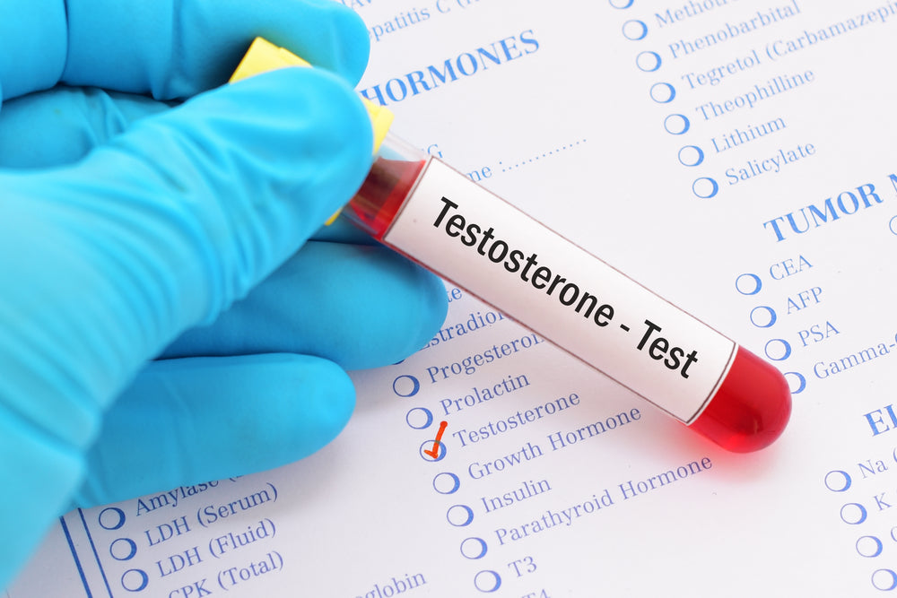 Why Would You Order a Testosterone Test?