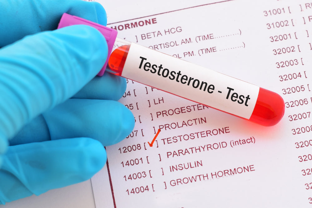 Home Testosterone Test - Check for Low Testosterone