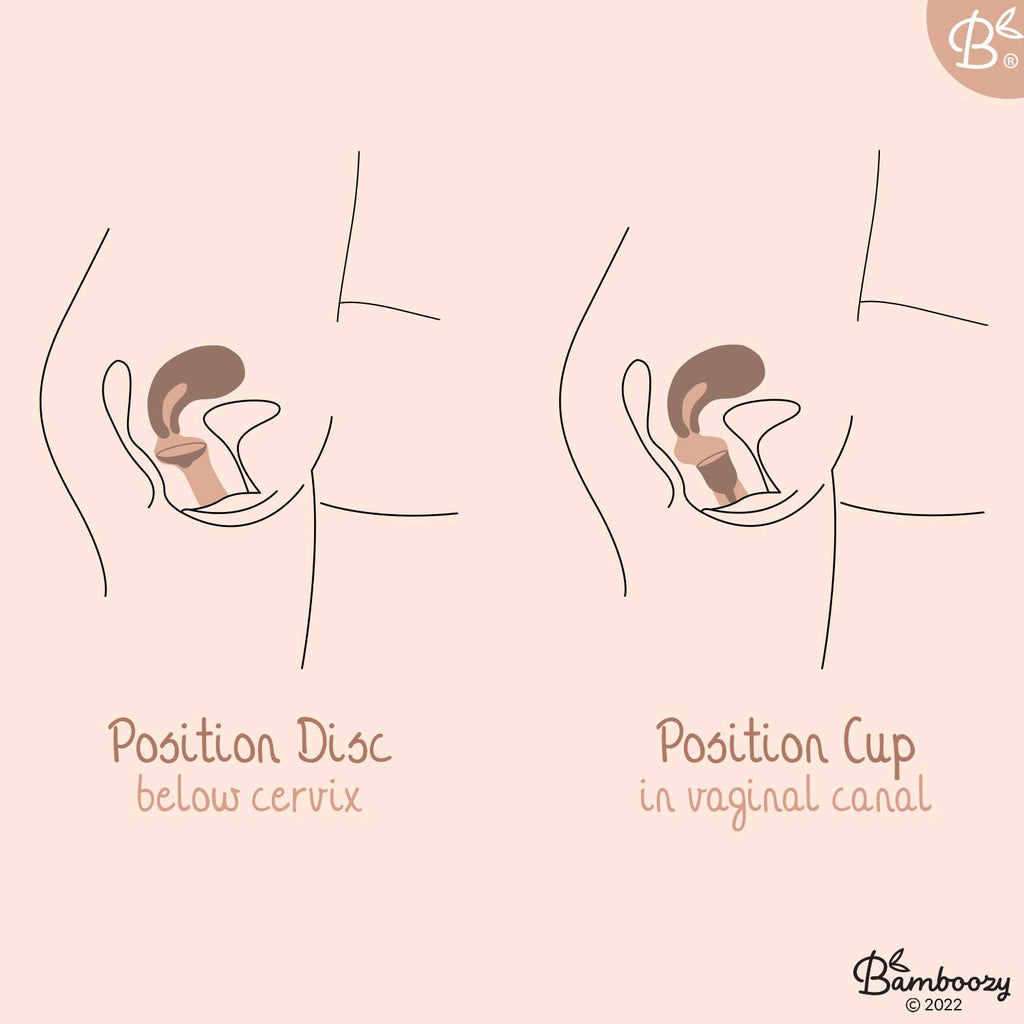 cup vs disc positions