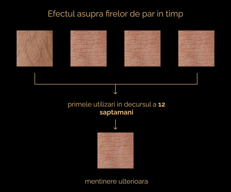 Primele utilizari si mentinerea ulterioara - epilatorul IPL Premium Sellfluence