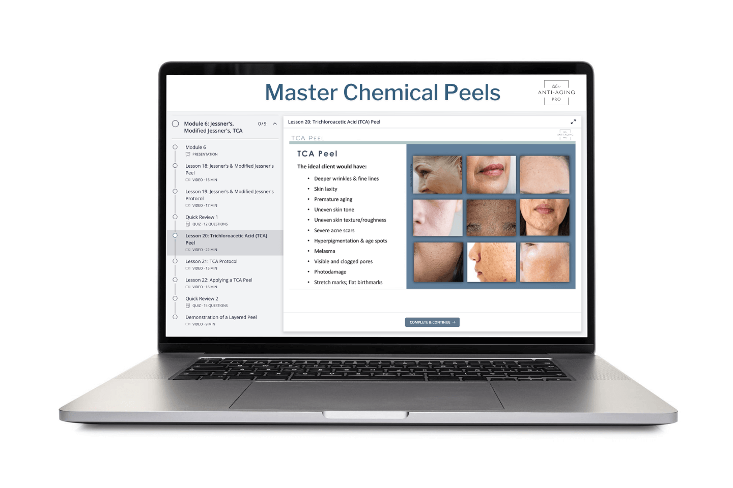 Online course for chemical peel training