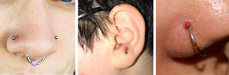 Pair keloid pressure earring fake piercing, Keloid earring keloid