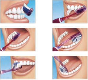 The Bass Method, also known as the horizontal flutter brushing method, is an effective brushing method for removing plaque in the gingival sulcus and on the tooth surface.