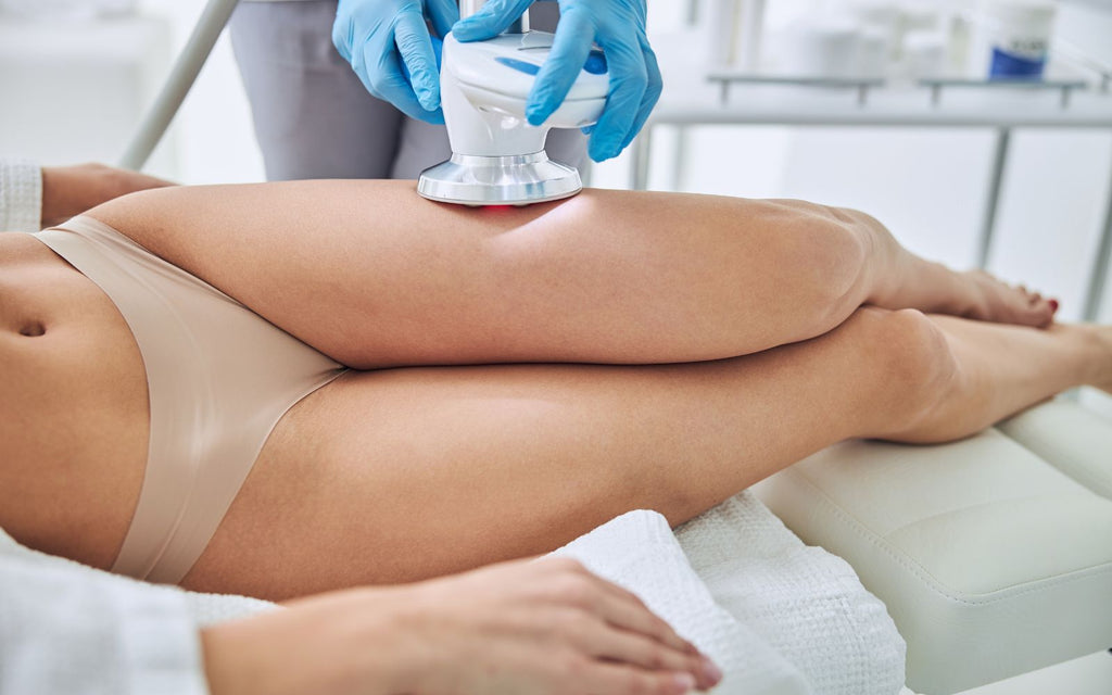 What is CoolSculpting?