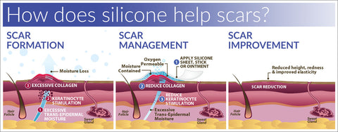 How silicone works