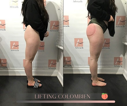 Résultat de Lifting Colombien