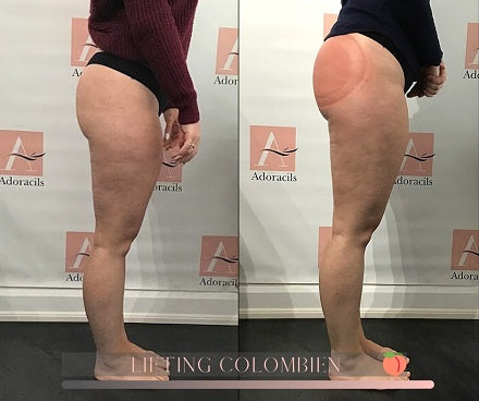 Colombian Lifting Results