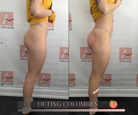 Colombian Lifting Results