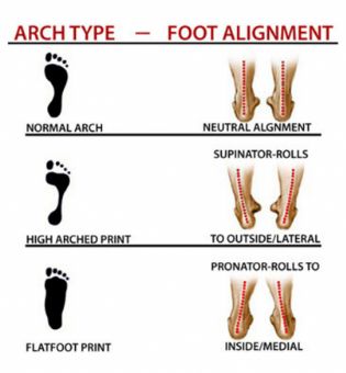 how-to-tell-if-you-have-high-arches