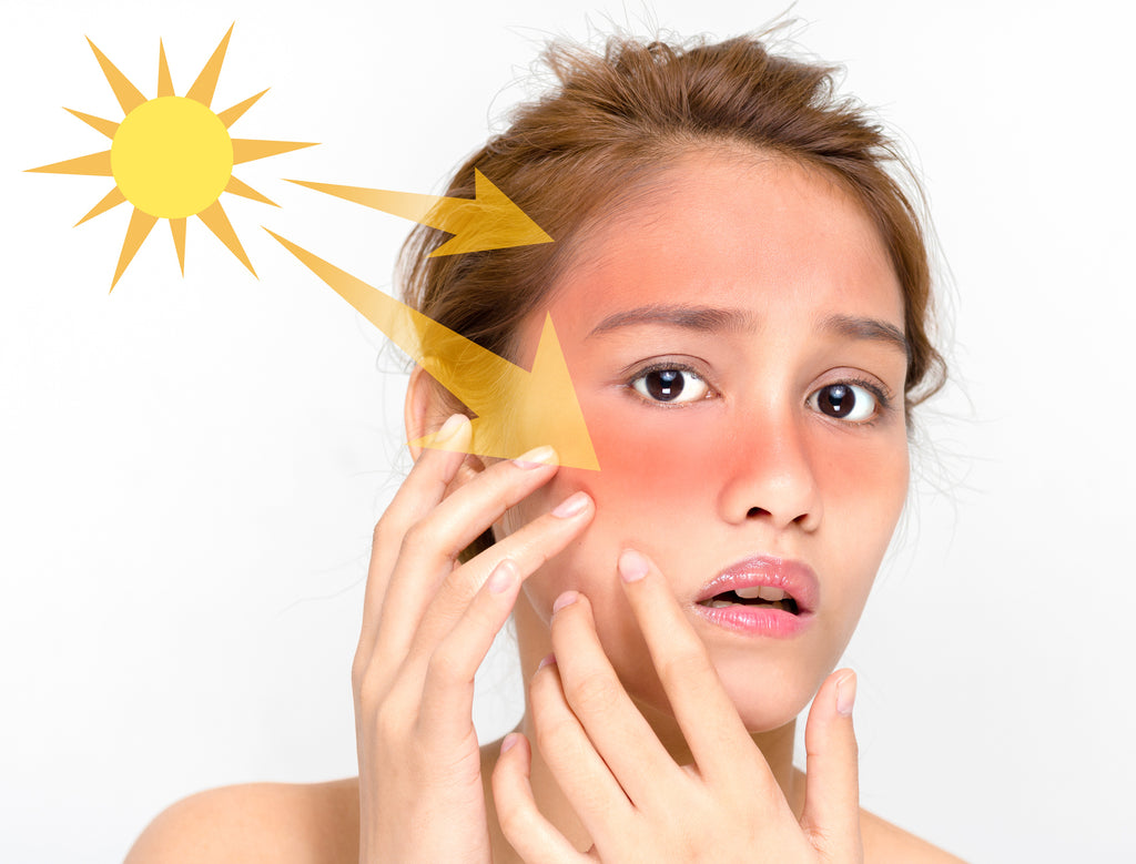 photosensitivity with toxic ingredients