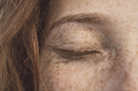 woman's eye and face with freckles