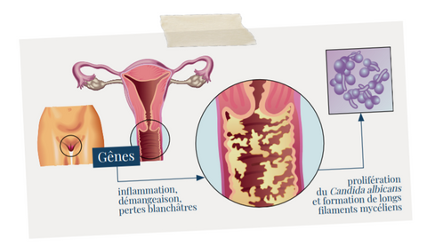 Tout comprendre sur les mycoses vaginales et sur Candida albicans