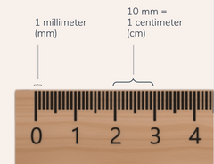 ruler annotated with 1cm and 10mm