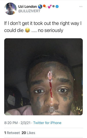 Lil Uzi Vert Puts A Pink Diamond On His Forehead Wjb