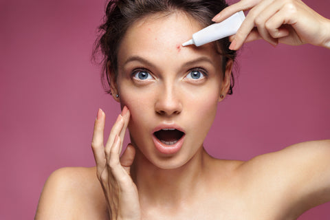 Young girl in shock of her acne.