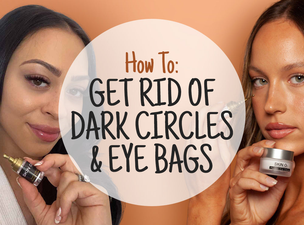 How to Get Rid of Dark Circles Or Eye Bags