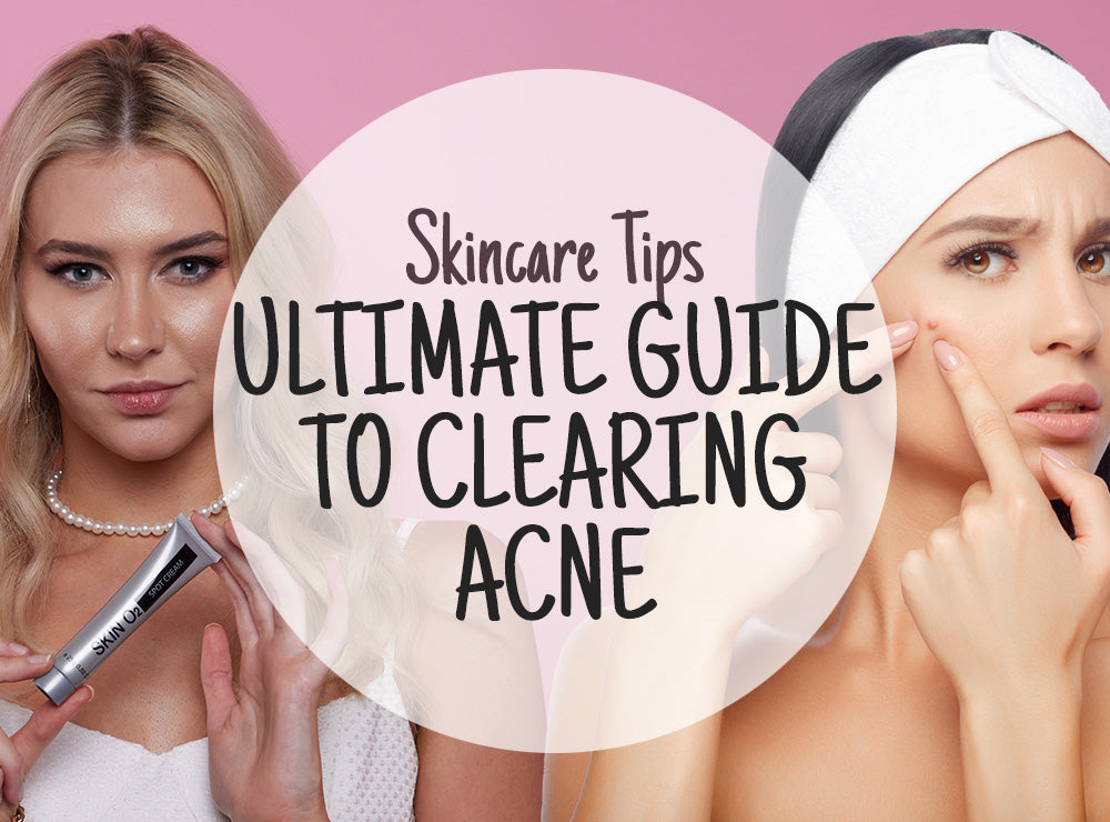 The Ultimate Guide to Clearing Acne: Top Skincare Tips and Products