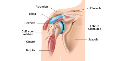 tendinite del sovraspinoso della spalla