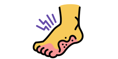 sindrome di raynaud ai piedi