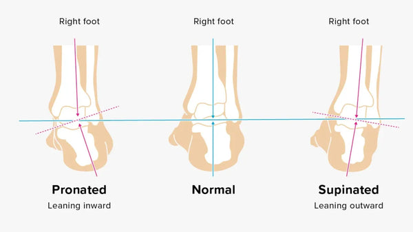 Guide to Foot Pronation