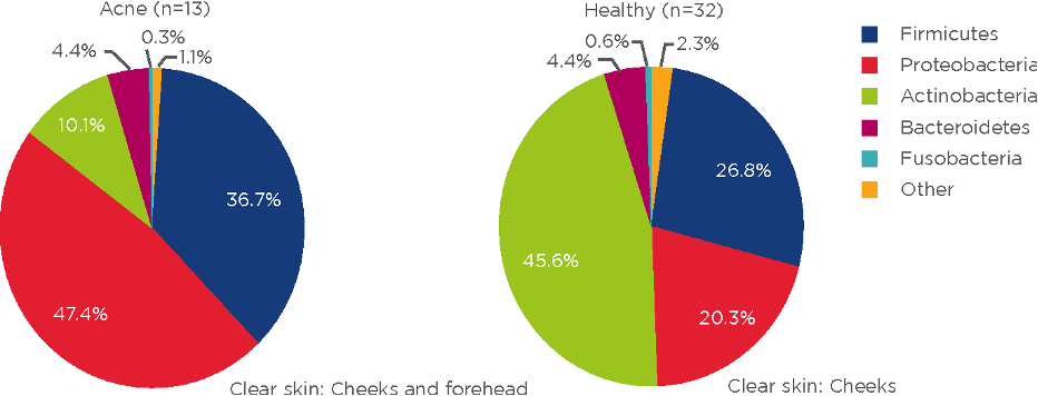 acne and the skin microbiome