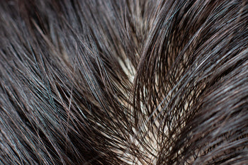 Everything You Need To Know About Oily Hair