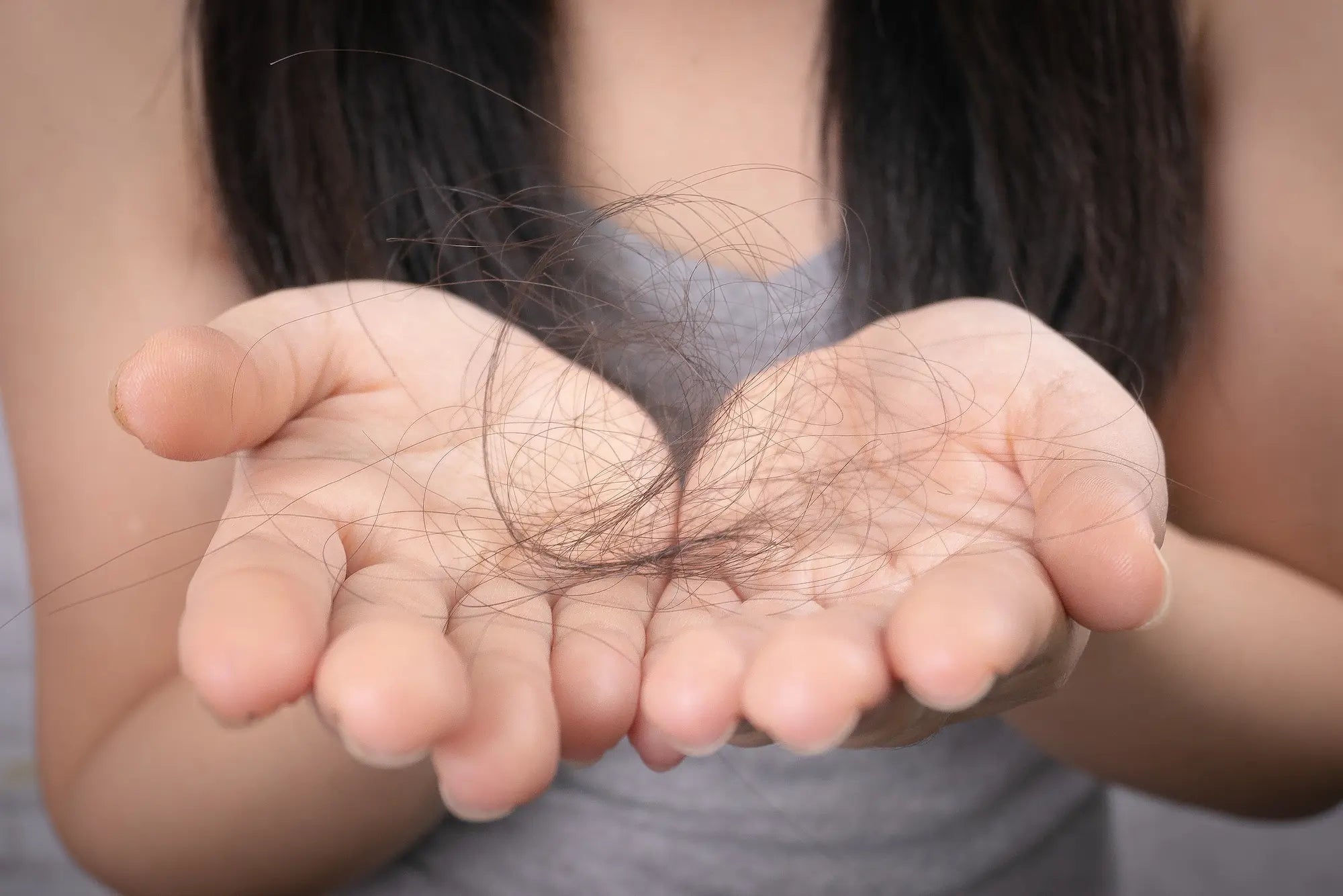 how to prevent postpartum hair loss