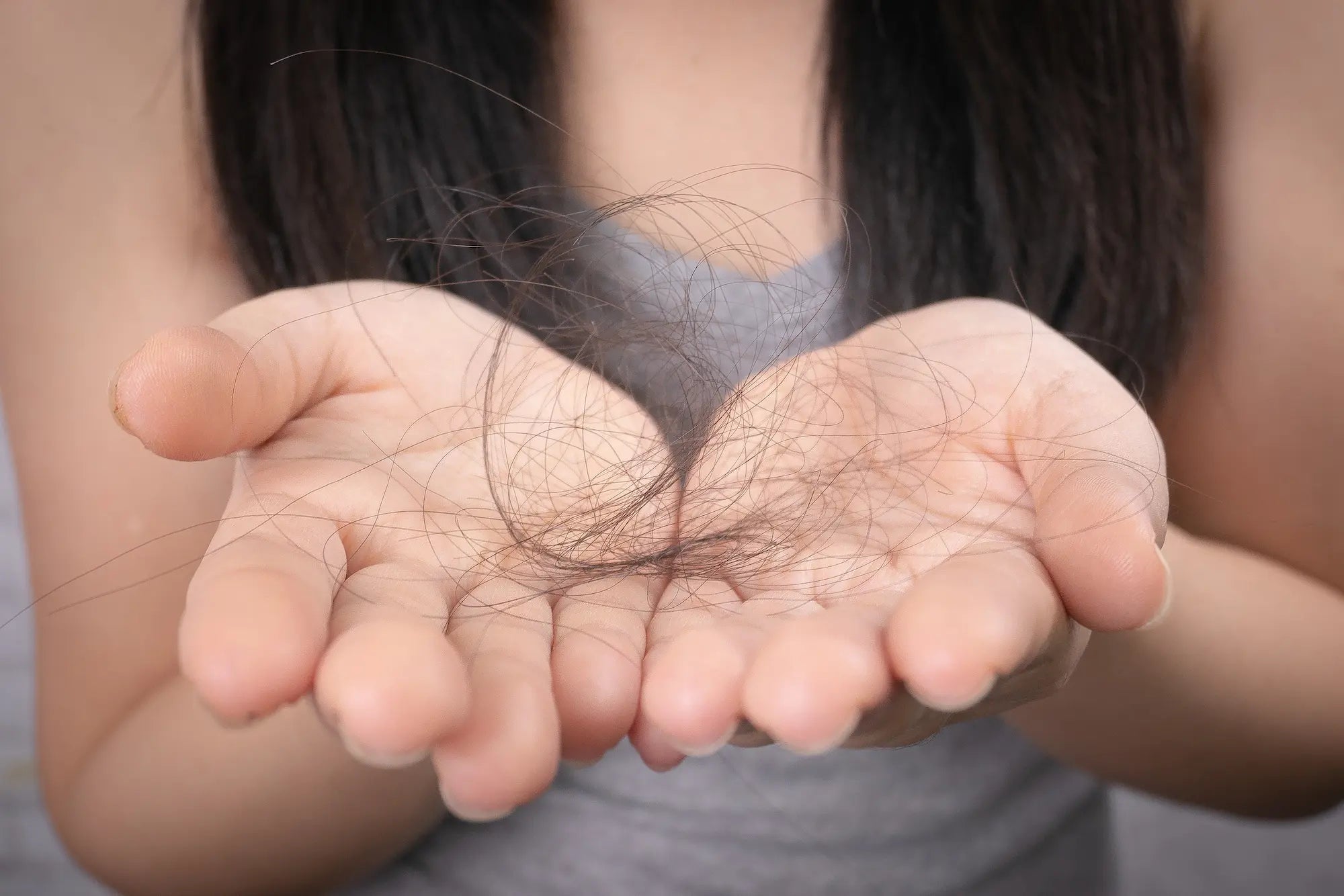 causes of hair thinning