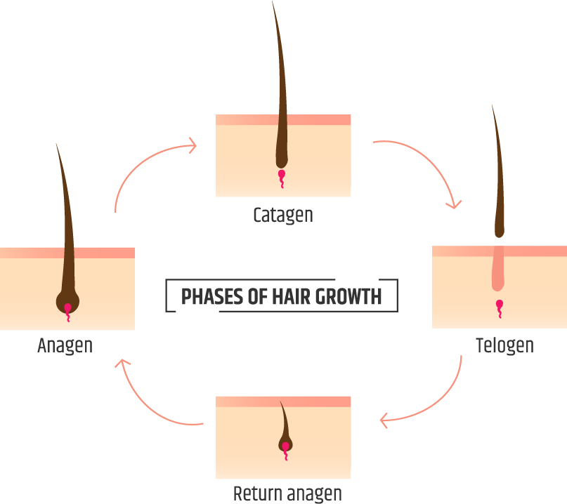 Male Pattern Hair Loss  Valley Skin Institute