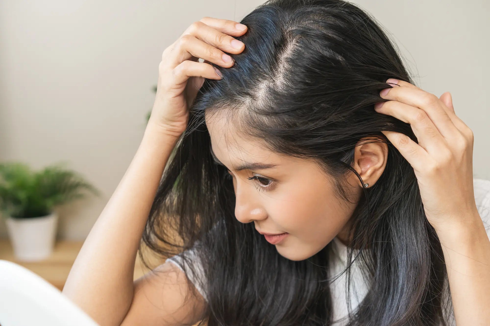types of alopecia