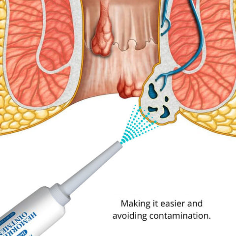 HealmuszPro Natural Herbal Hemorrhoids Ointment