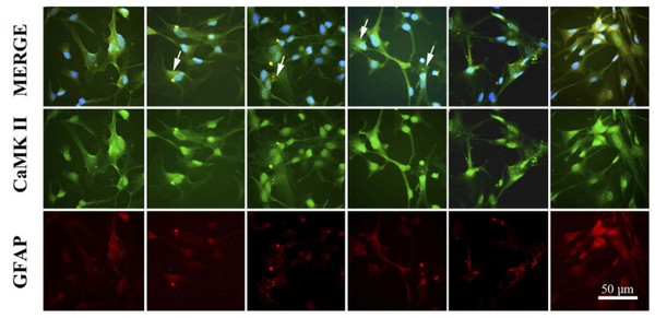 CamKII in human astrocytes