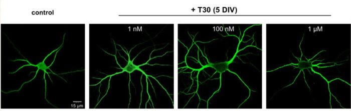 MAP2 stained neurons