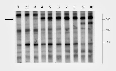 serum signal variability