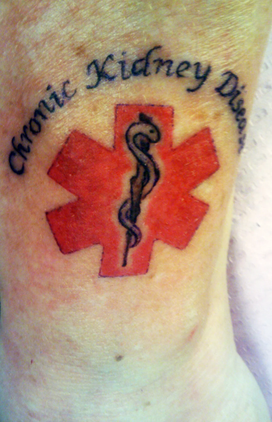 Medical Condition Tattoo